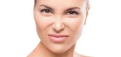 Nasenfalten Bunny Lines Faltenbehandlung Wien Botox